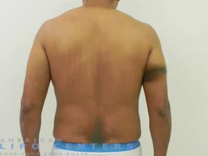 americanlipocenters_203.jpg